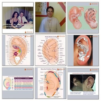 Curso Auriculoterapia e Aurículo Medicina Francesa