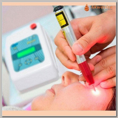 Laser em Manchas Olheiras Acnes e Rejuvenescimento