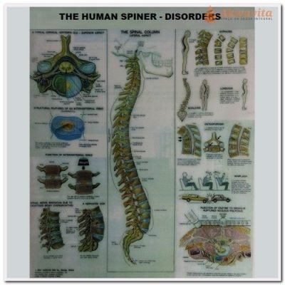 Poster The Human Spine Disorders Plastificado