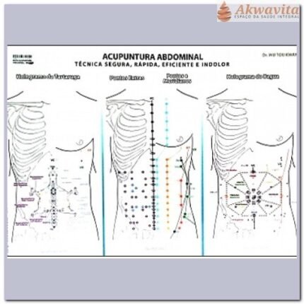 Mapa de Acupuntura Abdominal Dr Wu Plastificado