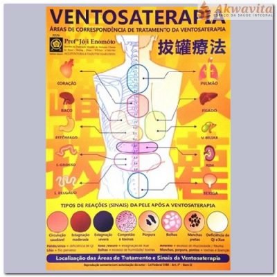 Mapa Ventosaterapia na MTC Enomóto Plastificado- Sogo