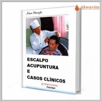 Escalpo Acupuntura e Casos Clínicos Jiao Shunfa