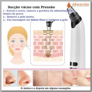 Kit Ventosa Elétrica Facial Tonificação e Extração Cravos